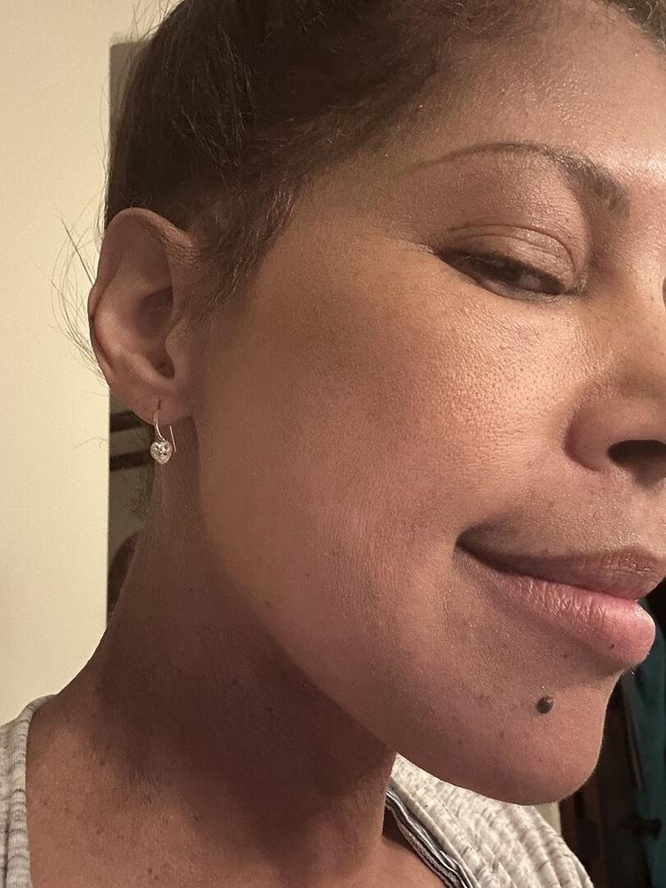 Medical Plastic Heart Pendant Earrings - Customer Photo From Sonja A.