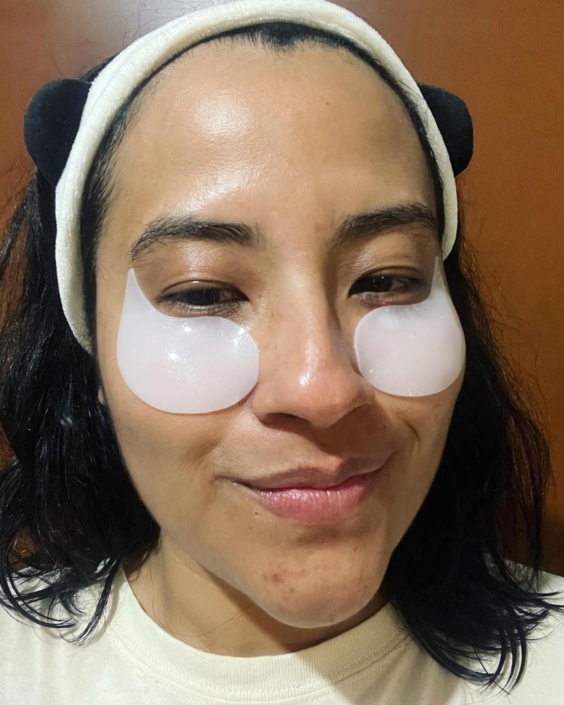 Eye Shine Hydrogel patches - Customer Photo From Andrea 