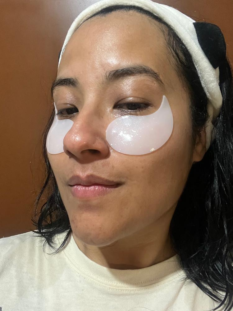 Eye Shine Hydrogel patches - Customer Photo From Andrea 