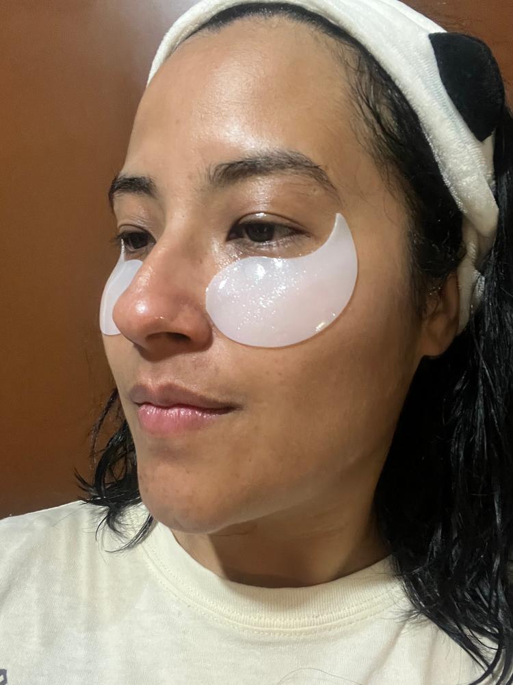 Eye Shine Hydrogel patches - Customer Photo From Andrea 