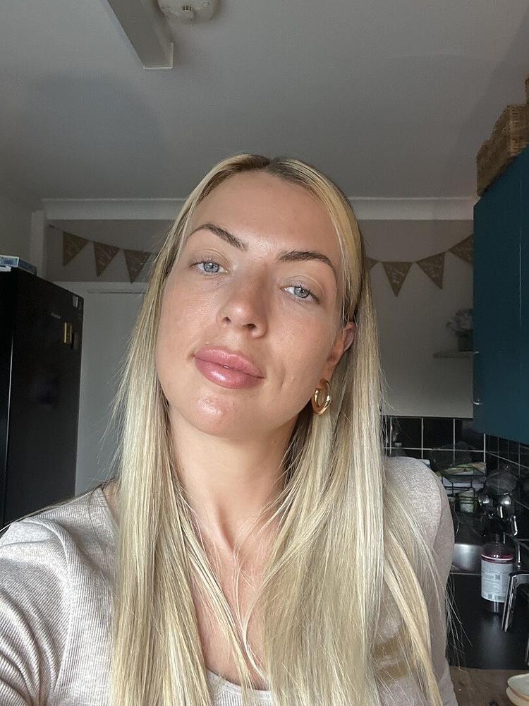 Really Good Vitamin E Oil 50ml - Customer Photo From Josie M.