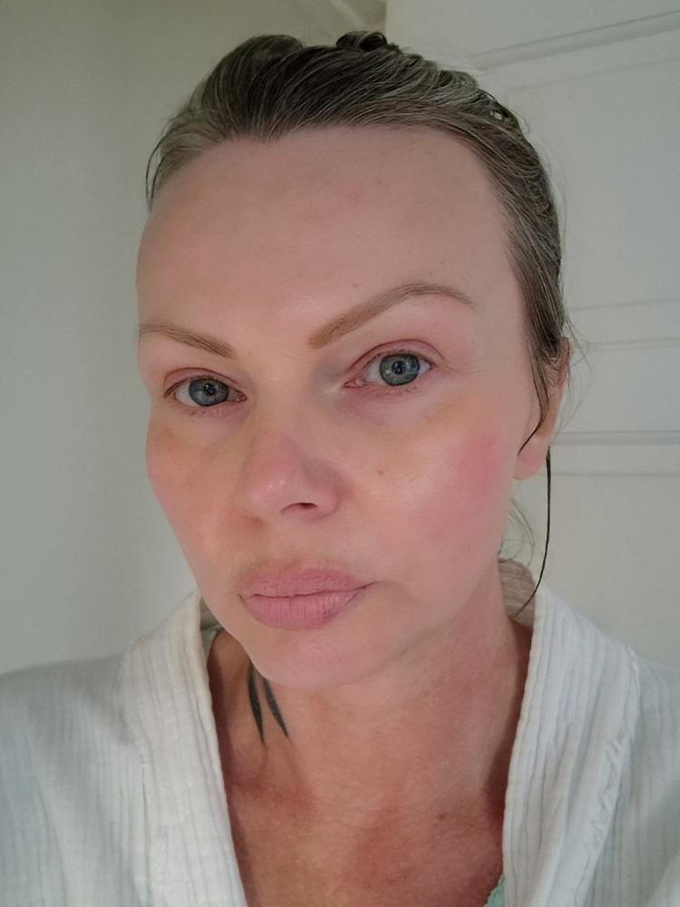 Organic Rosehip Oil 30ml - Customer Photo From Victoria Shephard