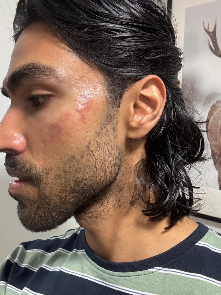 Organic Aloe Gel 150ml - Customer Photo From Haseeb