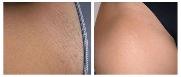  - Customer Photo From Candace Lacy