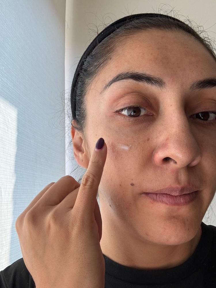 Crema de Ácido Hialurónico - Customer Photo From Cindy adriana 