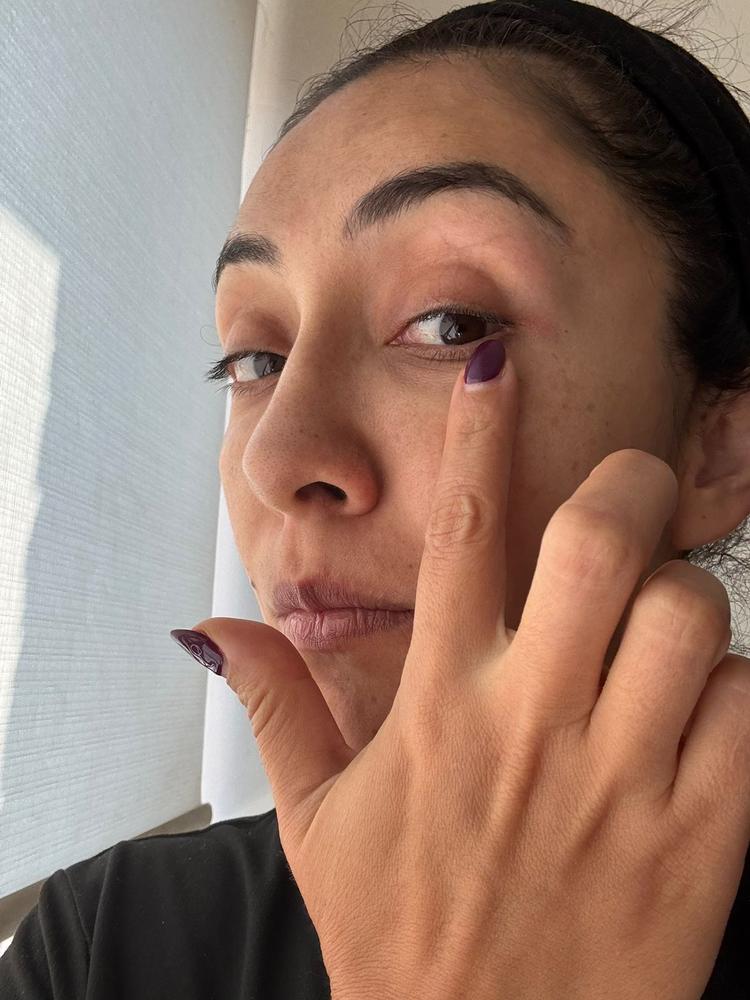 Crema de Ácido Hialurónico - Customer Photo From Cindy adriana 