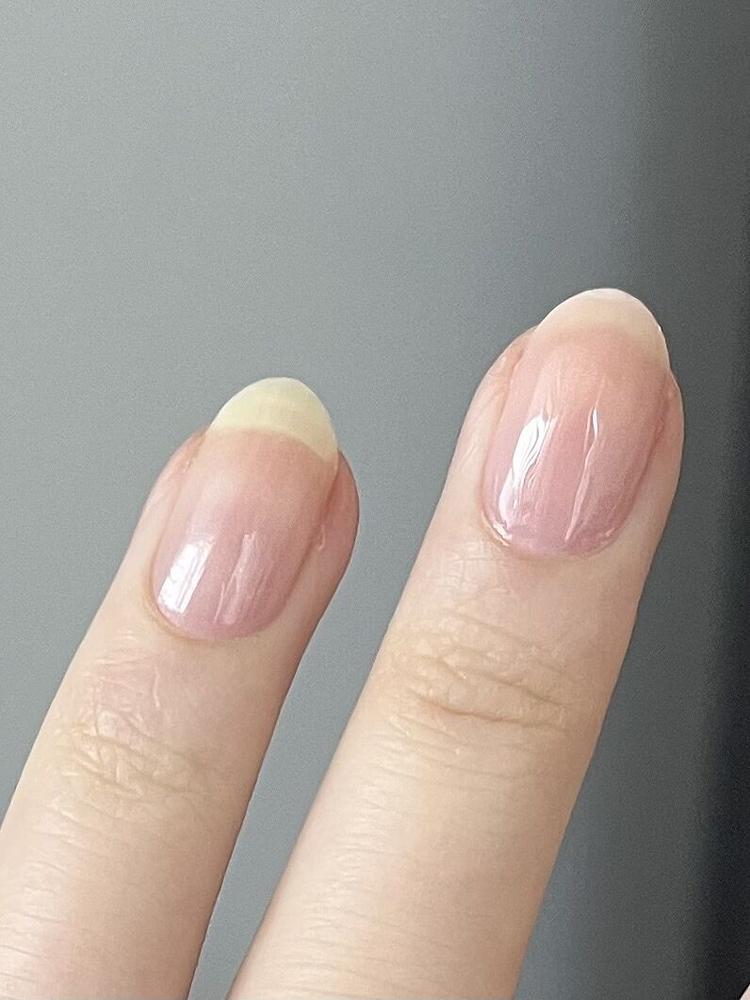 Clean Slate Ridge Filler - Customer Photo From Grace L.