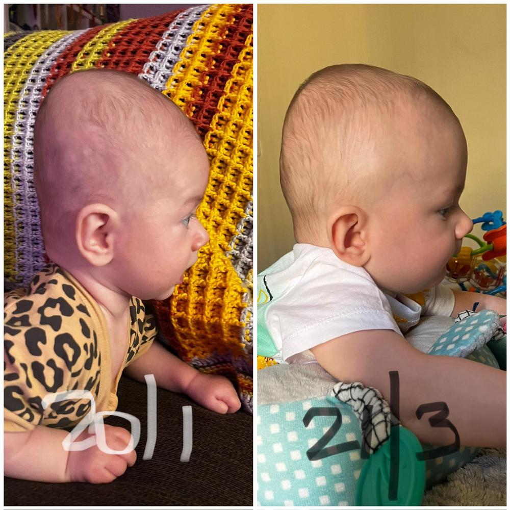 Perfect Noggin Head Shaping Mattress - Customer Photo From Lauren Chambers