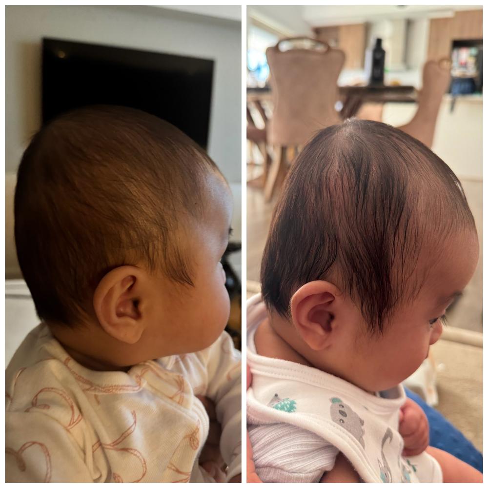 Perfect Noggin Head Shaping Mattress - Customer Photo From Kristine Garcia