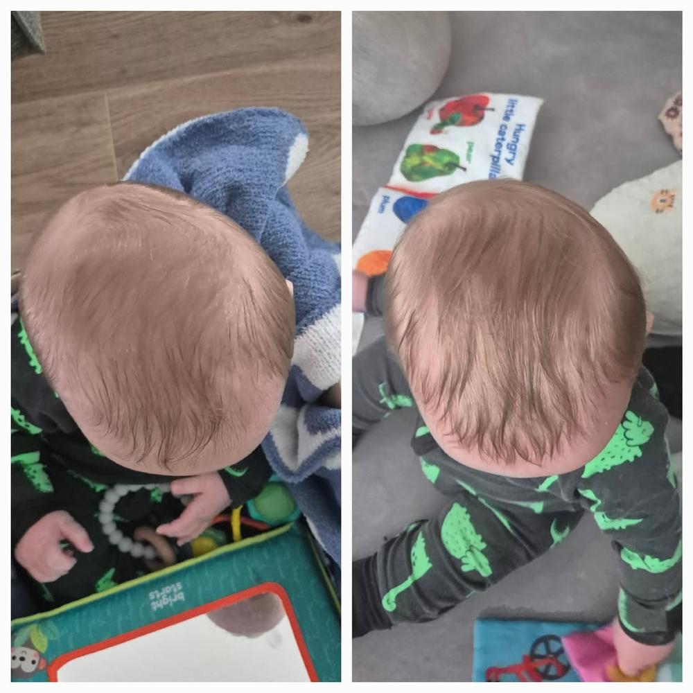 Perfect Noggin Head Shaping Mattress - Customer Photo From Dawn McCorkell