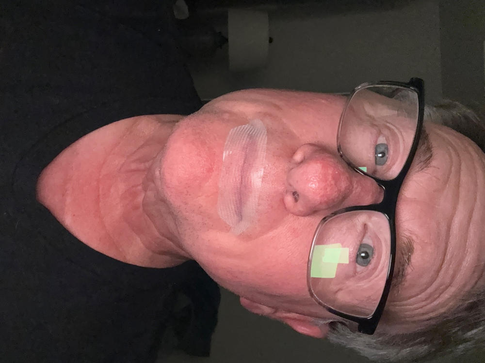 SomniFix Mouth Strips - Customer Photo From Lee Kirby