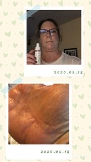Hand Sanitizer Spray - Customer Photo From Nancy Kuntz