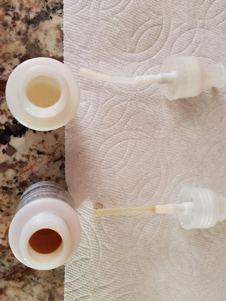 Dark Spot Remover - Customer Photo From Donna