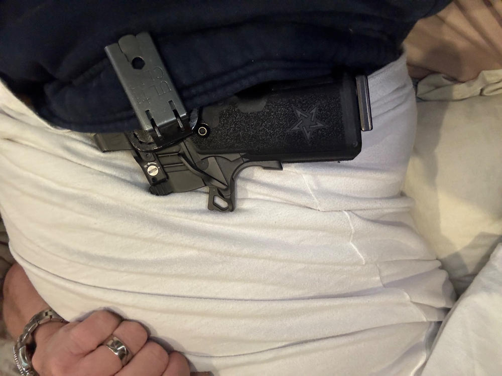 Staccato P Appendix Holster With Claw - Customer Photo From Richard P Boone