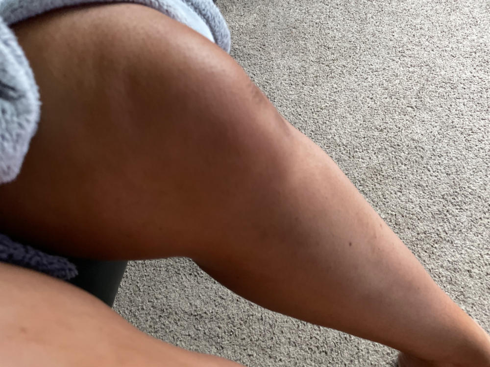 Wonder Serum 145ml - Customer Photo From Anonymous