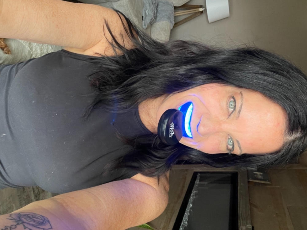 Molr Wireless LED Teeth Whitening Kit - Customer Photo From Mary A.