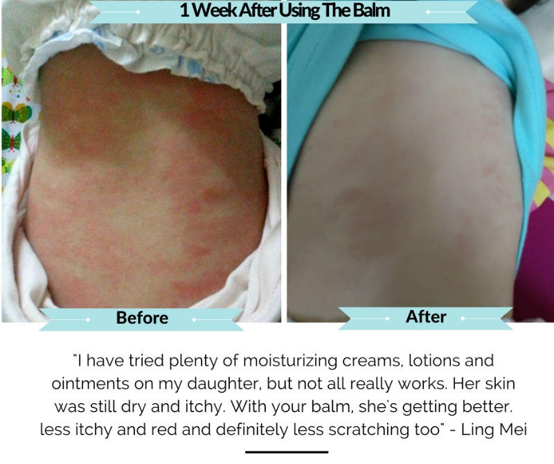 Conqueror Soothing Dry Skin Balm - Customer Photo From Cin King