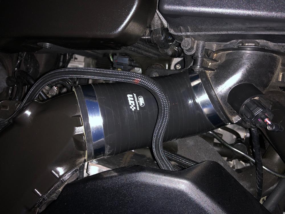 Hose Clip Kit (Induction) [Mk3 Focus RS/ST] - Customer Photo From Dave B.