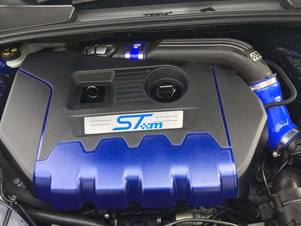 Hose Clip Kit (Induction) [Mk3 Focus RS/ST] - Customer Photo From Anonymous