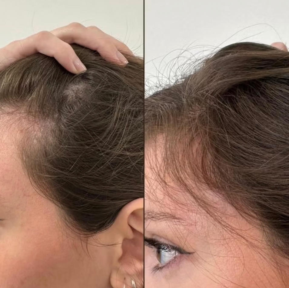 Hair She Is Hair Growth Serum - Customer Photo From Emily K.