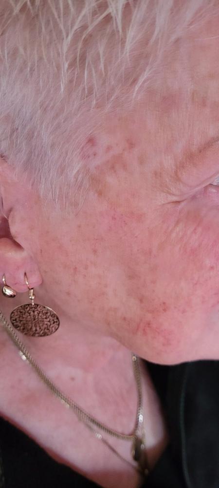 Facial Konjac Sponge - Pure - Customer Photo From Delcie Dolby