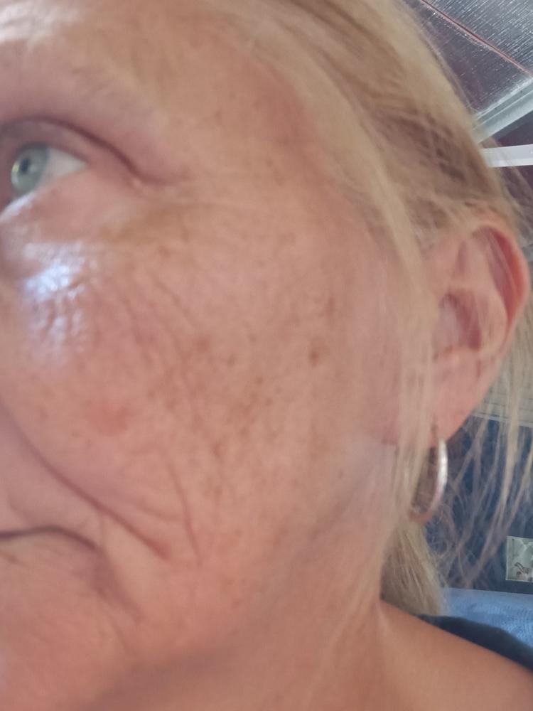 Dry Skin Trial Pack - 9g (10mL) Minis - Customer Photo From Mechelle Cunningham