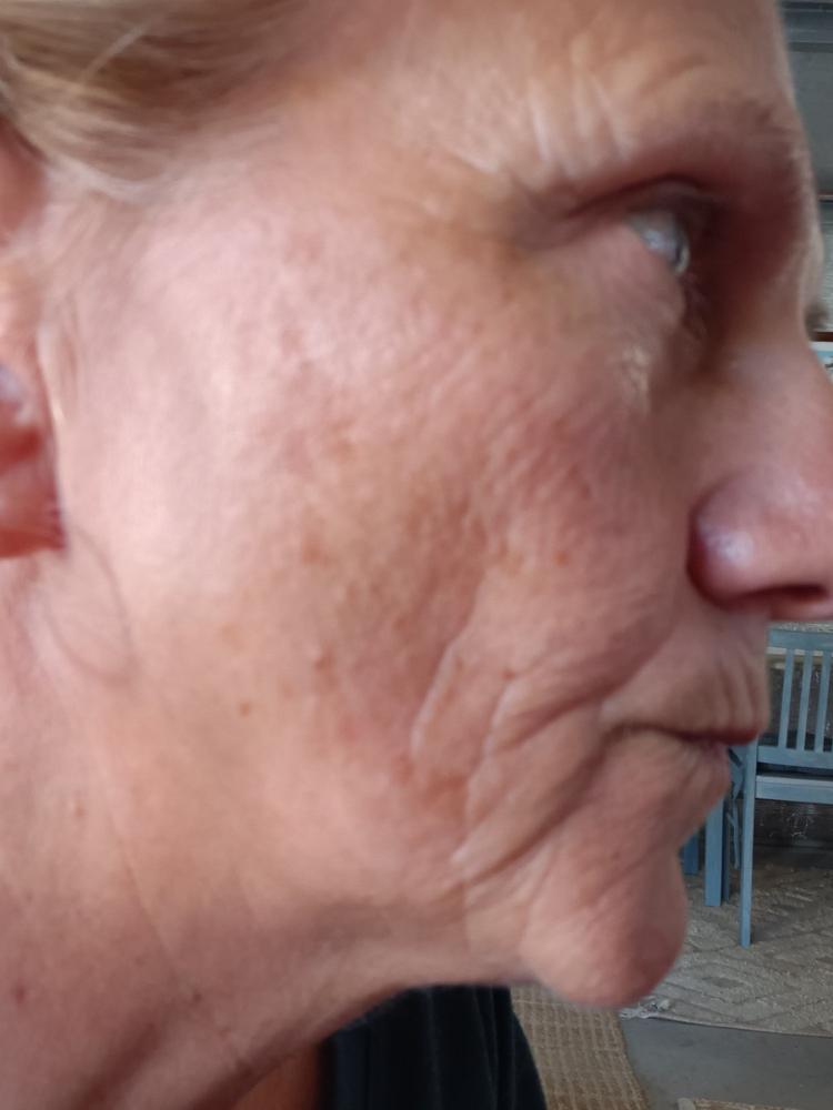 Dry Skin Trial Pack - 9g (10mL) Minis - Customer Photo From Mechelle Cunningham