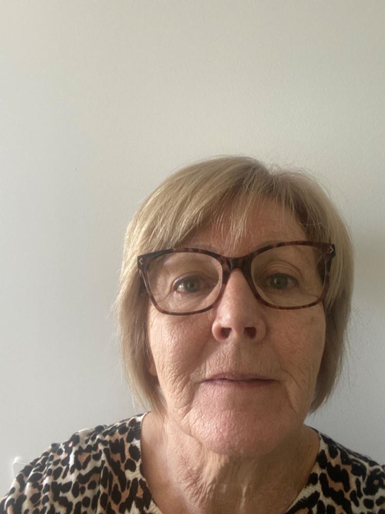 Sensitive Skin Trial Pack - 9g (10mL) Minis - Customer Photo From Patricua Percival