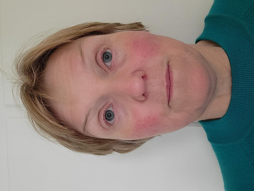Redness Prone Skin Trial Pack - 9g (10mL) Minis - Customer Photo From Joan Perry