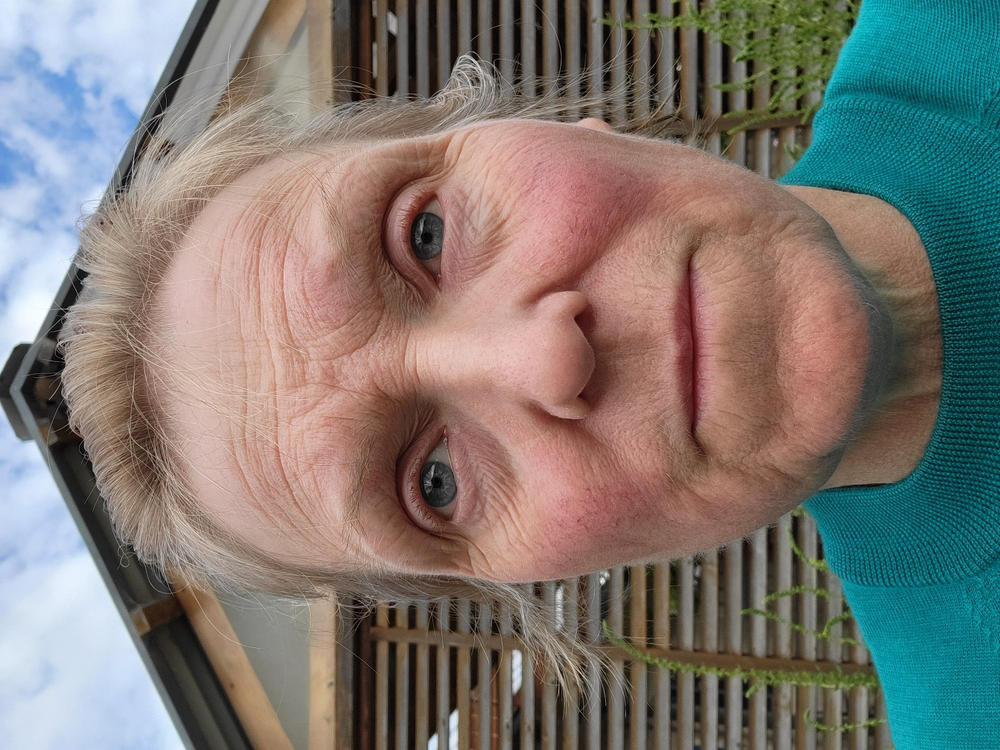 Redness Prone Skin Trial Pack - 9g (10mL) Minis - Customer Photo From Joan Perry