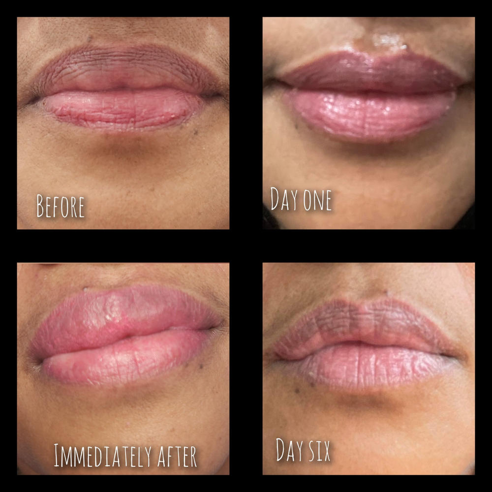 Lip Magic: Dark Lip Neutralization - Customer Photo From Amanda Hadfield