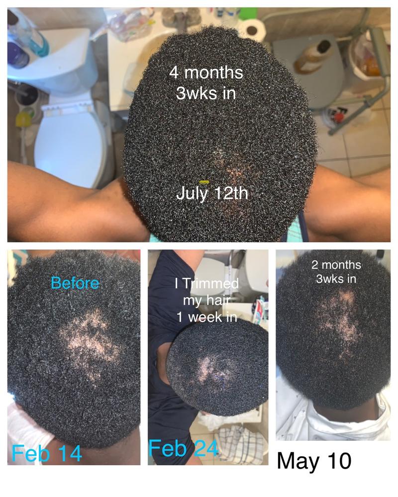 Men’s Trio: African Black Soap Hair Growth Shampoo, Hair Growth Conditioner, Organic Hair Growth Oil - Customer Photo From Jethro Armand