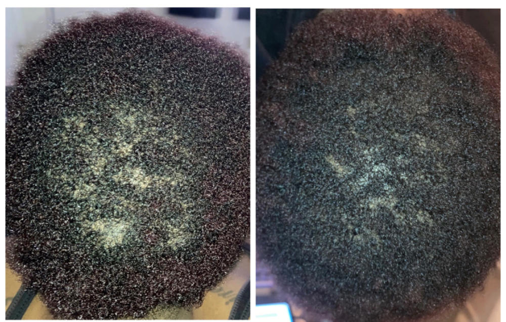 Organic Hair Growth Oil - Customer Photo From Anonymous