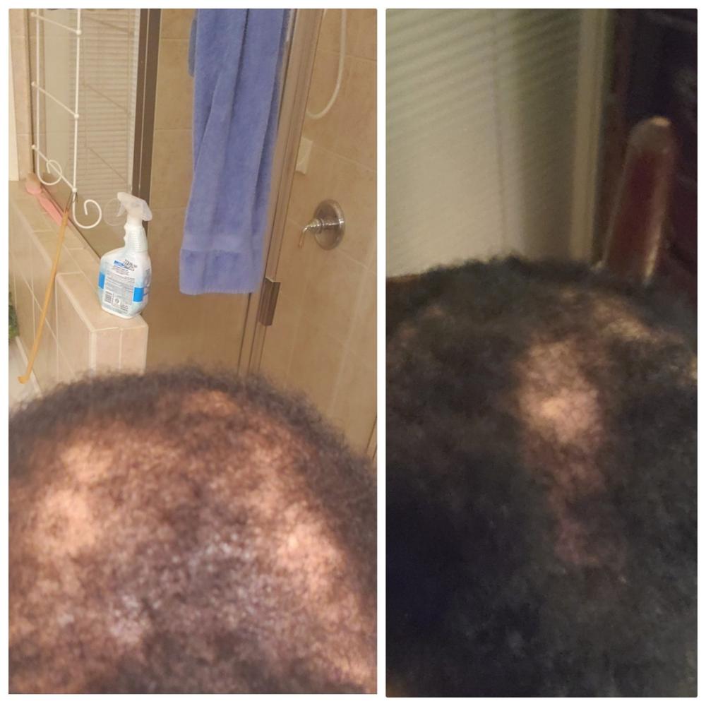 African Black Soap Hair Growth Shampoo - Customer Photo From Evetta Lawrence-Davis