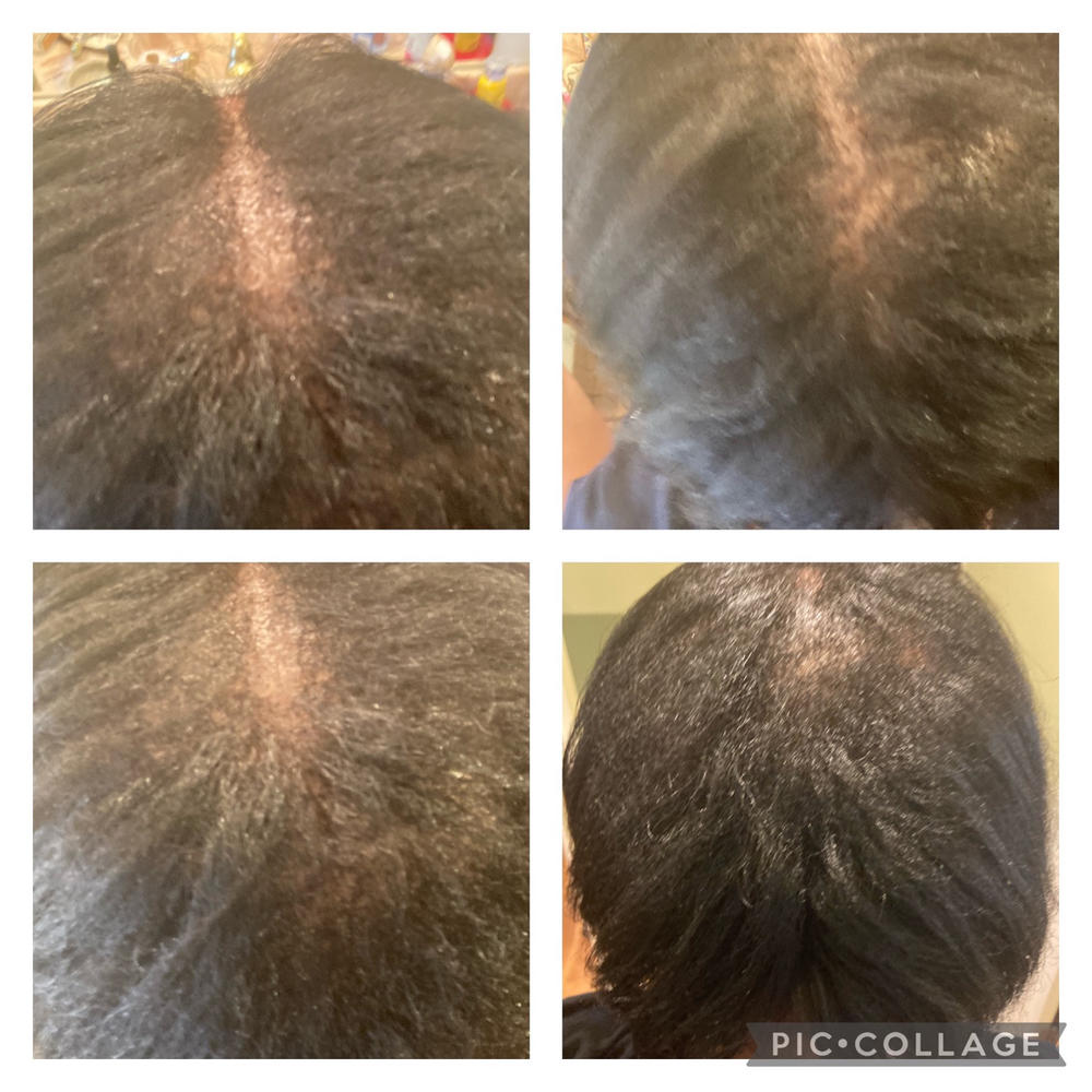 Trio Set: African Black Soap Hair Growth Shampoo, Hair Growth Oil, and Hair Growth Conditioner - Customer Photo From Nadalyn Williams