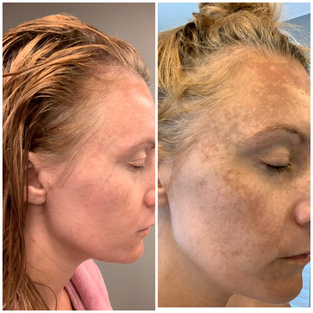 juice beauty peel