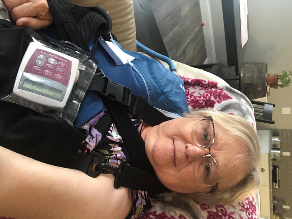 Aircast Cryo/Cuff IC Cooler - Customer Photo From Linda Absher