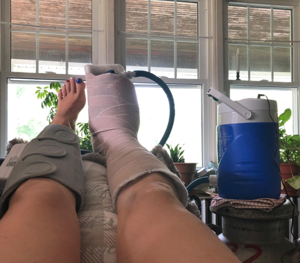 Cryo Cuff IC Motorized Cooler - Customer Photo From Sadie Peachey