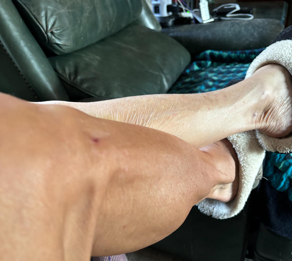 Dark Sunless Tanning Mousse - Customer Photo From Tiffany Dorr