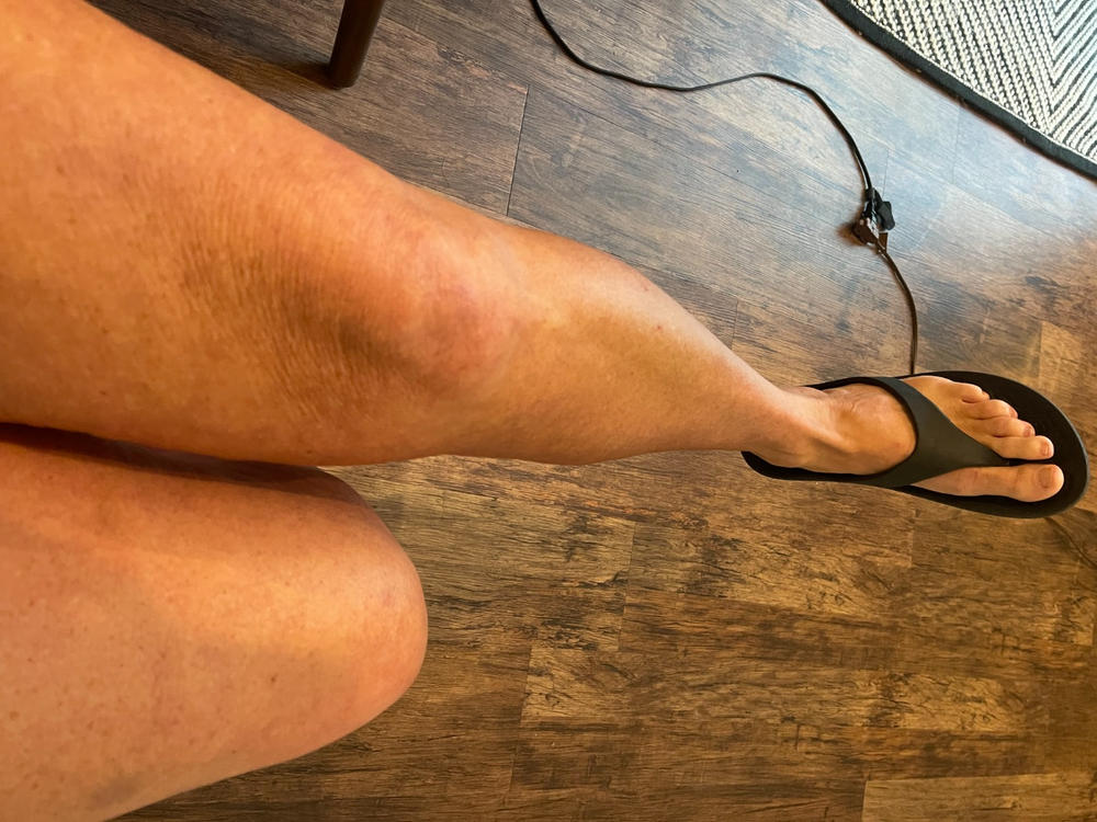 Self Tanning Drops - Customer Photo From Lori Davis