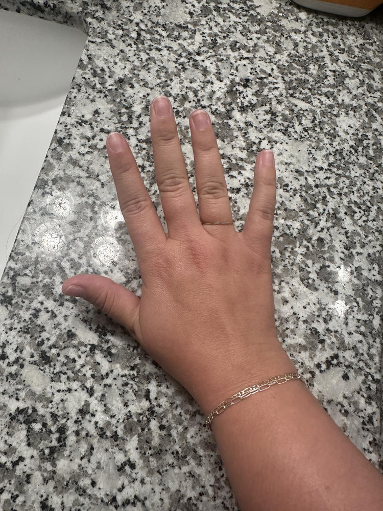 LITTLE GOLD BAND - Customer Photo From ROSEMARY BARLOW