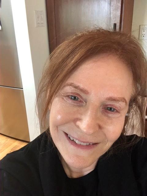 RESCUE VITAMIN C + SQUALANE SERUM - Customer Photo From betsy heimann