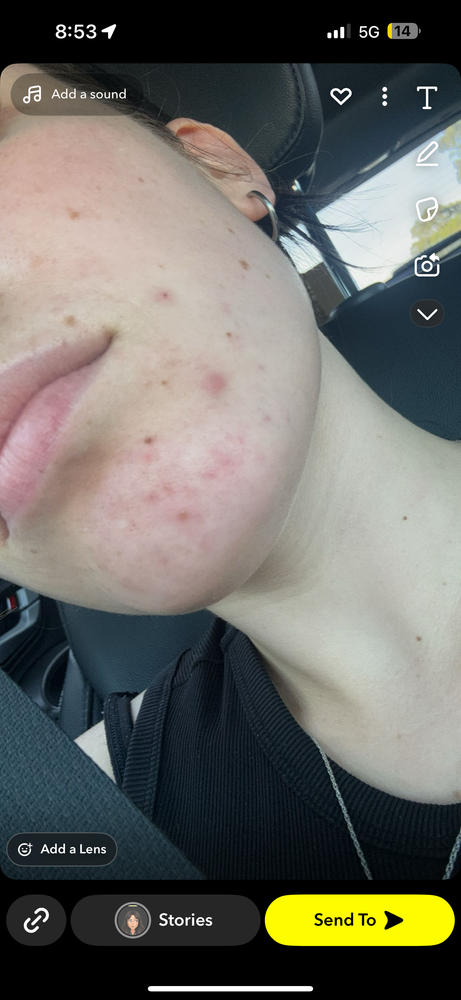 Radiance Foaming Cleanser - Customer Photo From Bella