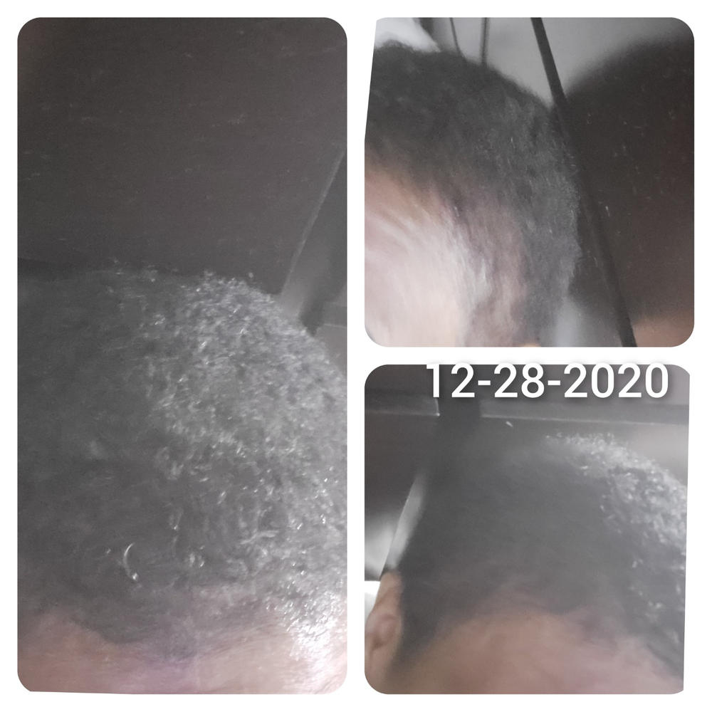 the Balm! - Hair Growth Treatment - Customer Photo From Tanya Quick