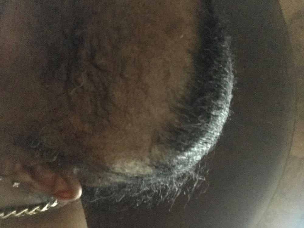 the Balm! - Hair Growth Treatment - Customer Photo From Gina Walker-Reed