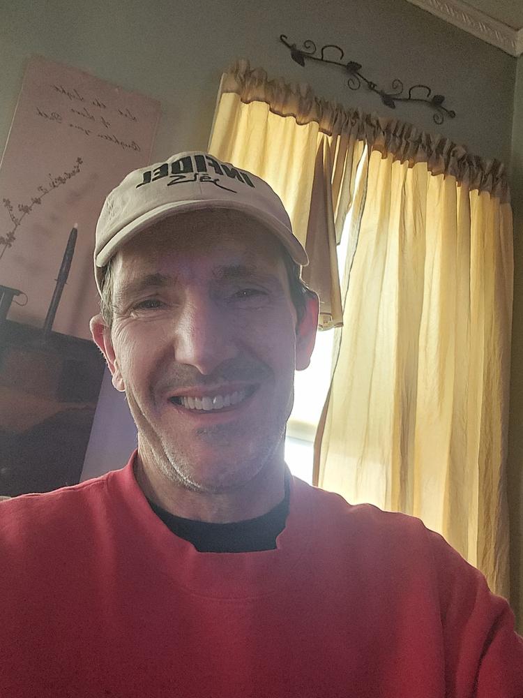 Patient Self Fitting - Functional Dentures - DIY - Flex Fit - Less Than 5 Minutes - Easy Denture™ - Upper & Lower Dentures - Customer Photo From Edward Battelli