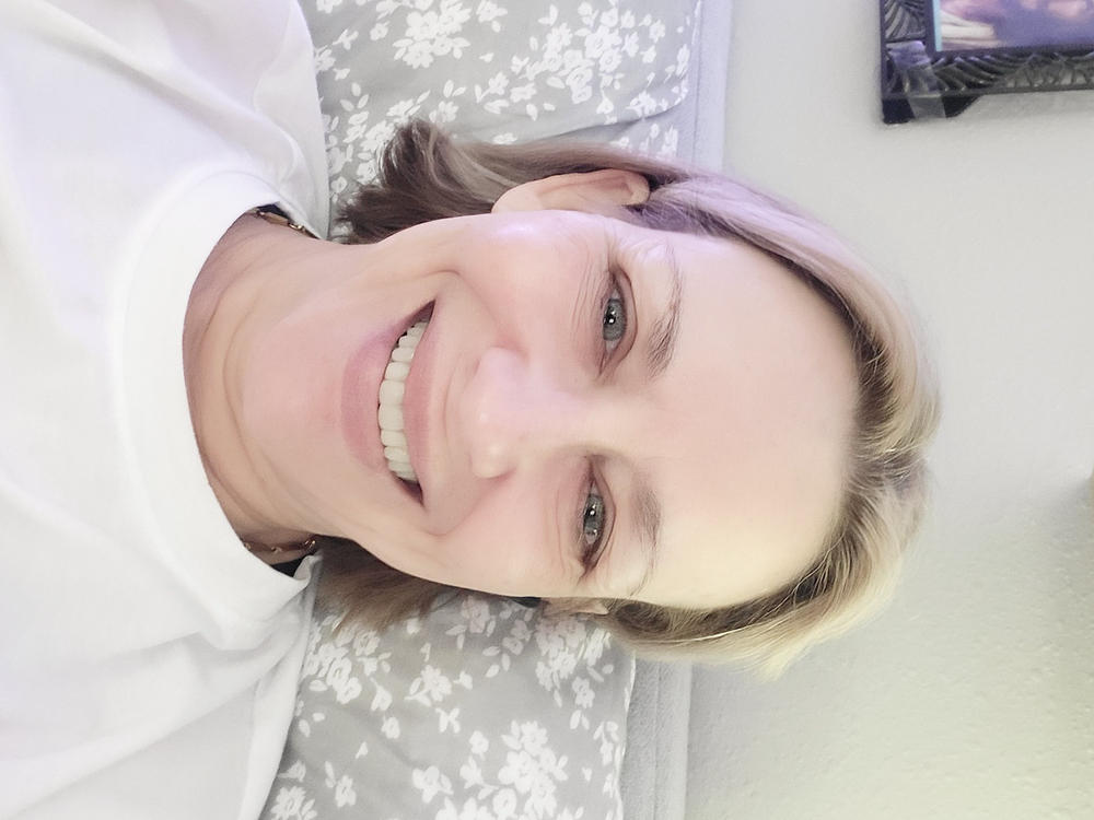 Patient Self Fitting - Functional Dentures - DIY - Flex Fit - Less Than 5 Minutes - Easy Denture™ - Upper & Lower Dentures - Customer Photo From Lisa McNeal
