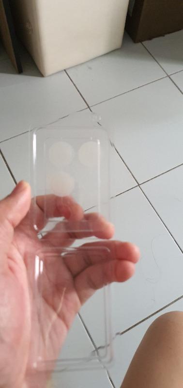 Deep Vita C Patch - Customer Photo From Zhian Syn Chong