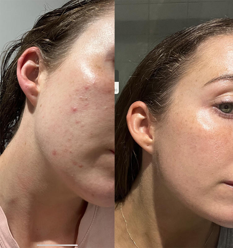 Skin + Gut Bundle - Customer Photo From Stephanie Hyde
