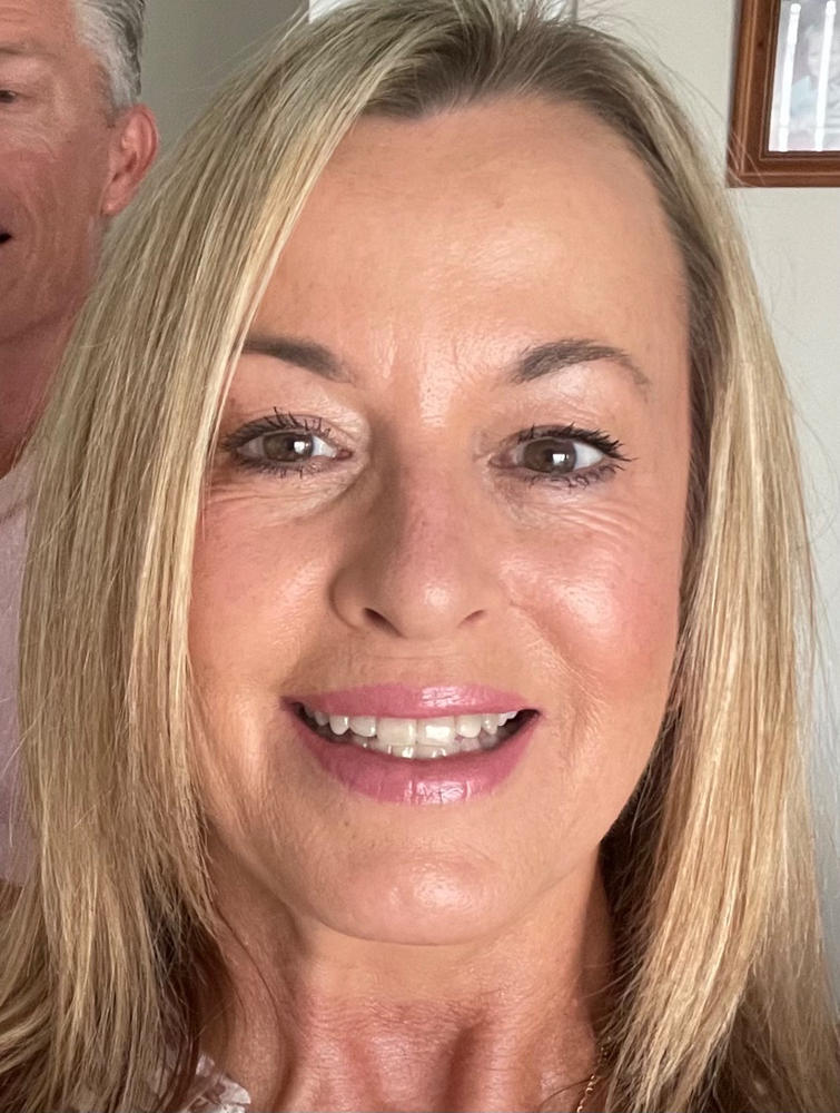 Collagen Eyes - Customer Photo From Robyn Gaskin